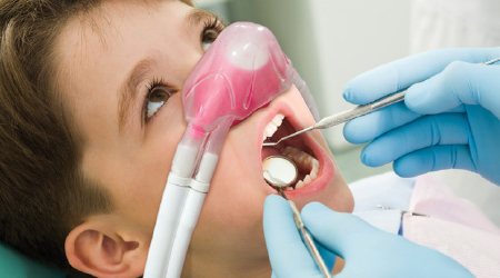 Nitrous Oxide Oxygen Sedation