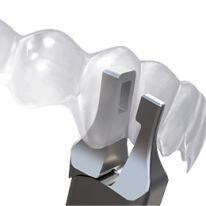 Orthodontic